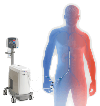 Image: The ZOLL Thermogard XP intravascular temperature management (IVTM) system (Photo courtesy of ZOLL).
